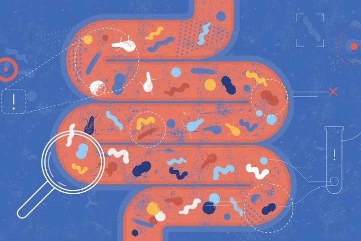 Enteral Nutrition Tube Feeding Graphic of Intestine