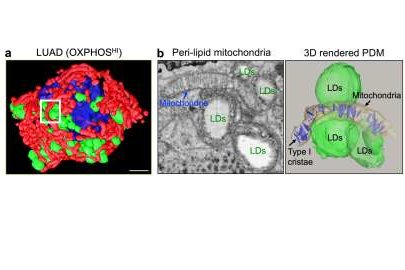 Mitochondria bound to lipid droplets in cells 