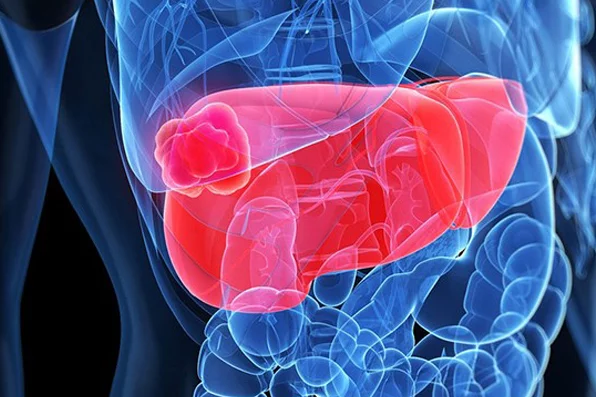 1984-ronald-busuttil-M.D.-Ph.D.-at-the-medical-school-opens-the-first-liver-transplant-program-on-west-coast