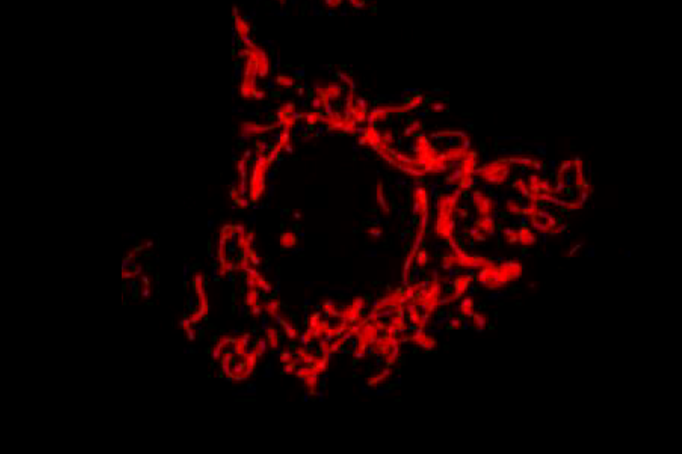 Mitochondria Lean Structure 