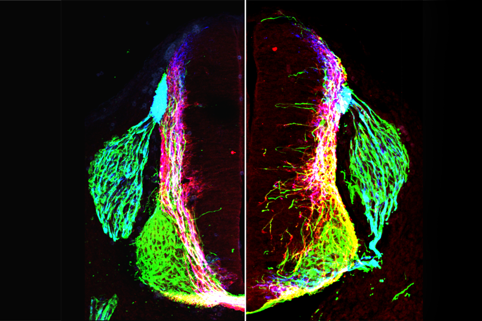 Transverse section of control or netrin1 mouse in neural circuits research