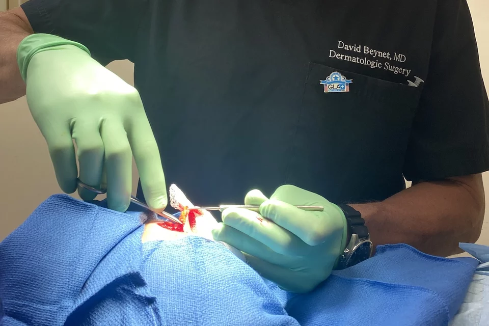 What is a dermatologist? Micrographic dermatologic surgery