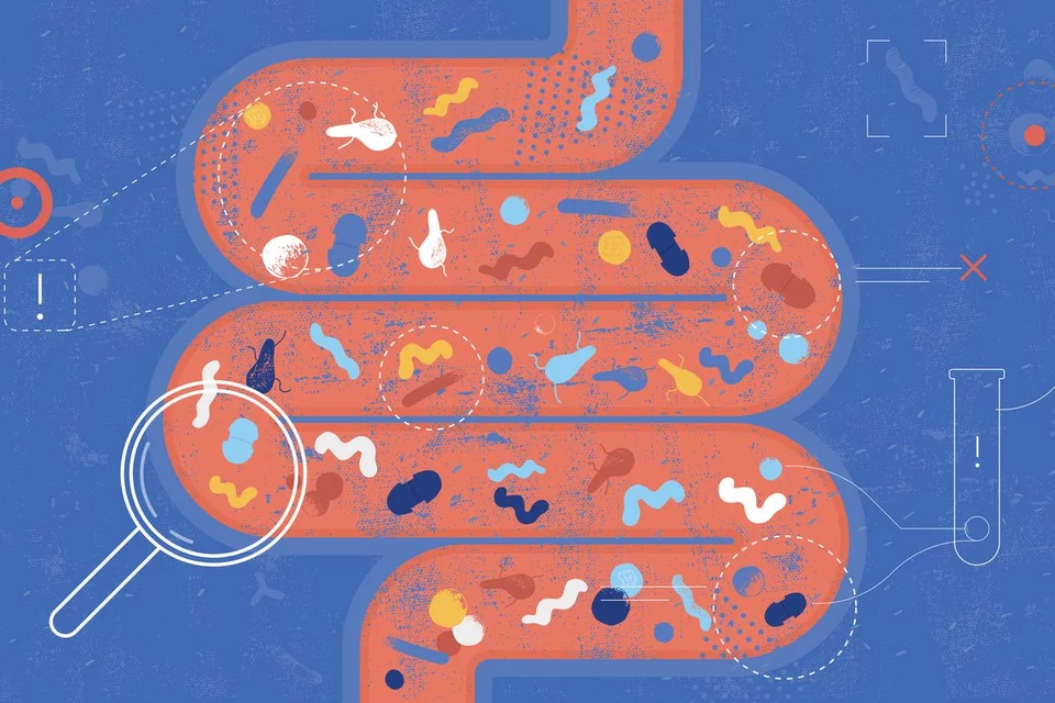 Enteral Nutrition Tube Feeding Graphic of Intestine