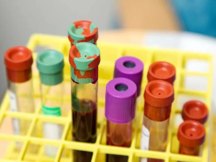 A new technology called PSMA might help identify men at risk