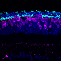 Cone photoreceptors in the degenerating retina