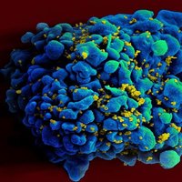 HIV infected H9 T-Cell NIAID