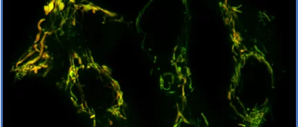 Mitochondria Function, Form and Food: A mitochondria fragments itself 