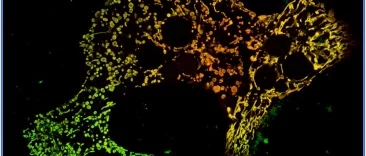 Mitochondria Function, Form and Food: A mitochondria changes shape to process excess nutrients