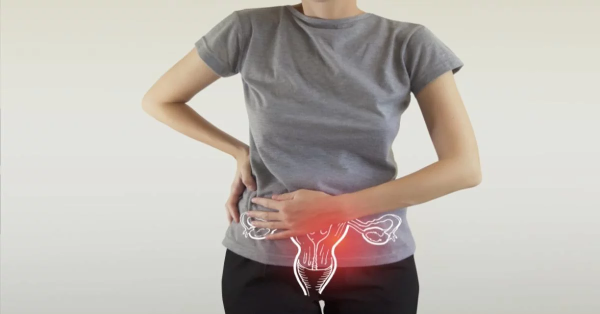 Endometriosis Symptoms, Treatment, Causes