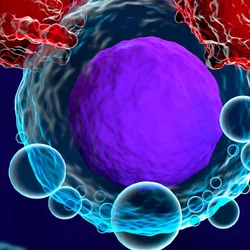 T cell cancer