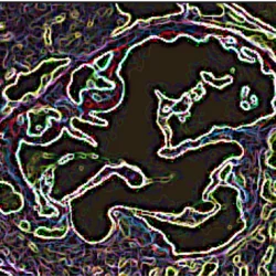 Lipoprotein