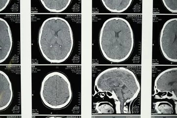 Medical Imaging of the Brain