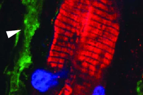Immunofluorescent staining demonstrating fibroblasts expressing the Channelrhodopsin protein in heart scar tissue. The ChR2-expressing fibroblast (green, arrow) is in close proximity to cardiomyocytes (red) within scar.